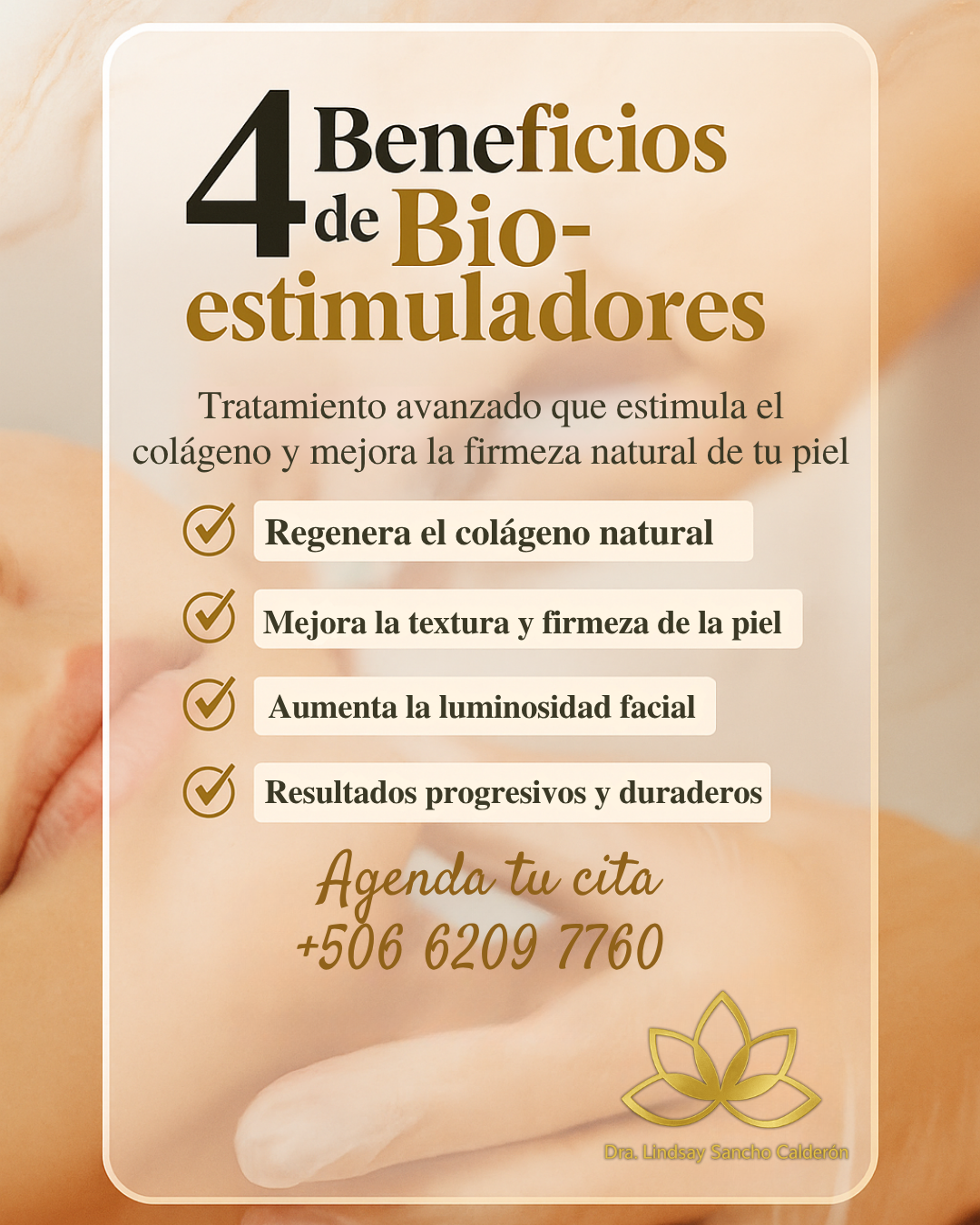 Lindsay — Diseño 1