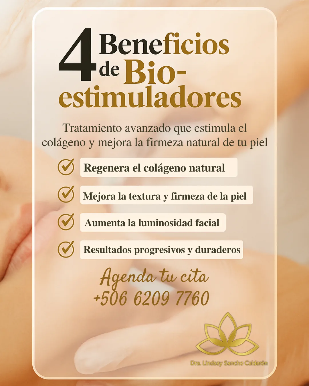 Lindsay — Diseño 1